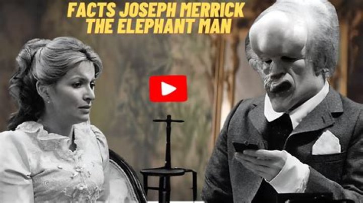 Joseph Merrick And The True Story Behind 'The Elephant Man'